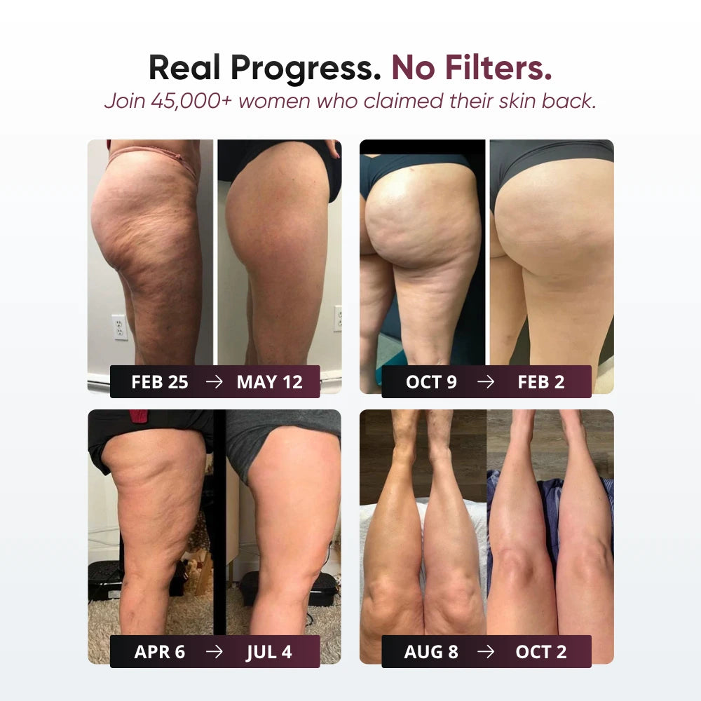 3D Anti-Cellulite Short